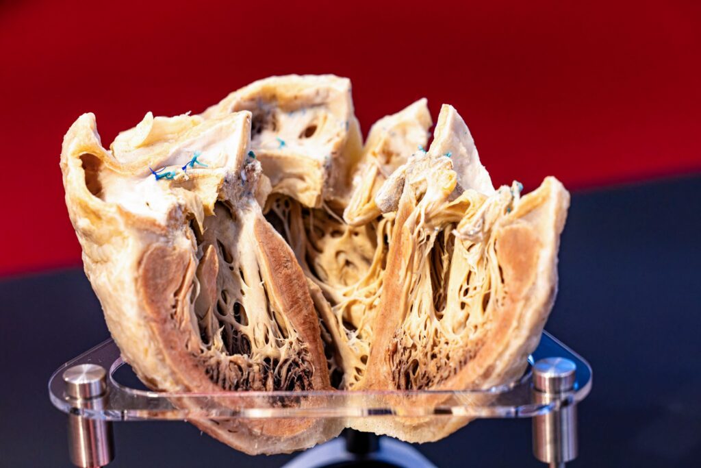 Gubener Plastinate und Plastinarium